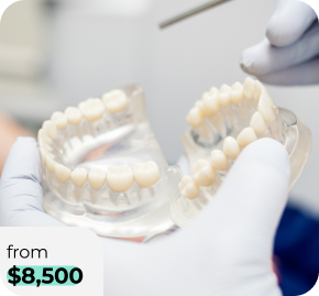 Gloved hands hold a dental plaster model of the upper and lower teeth with a dental instrument